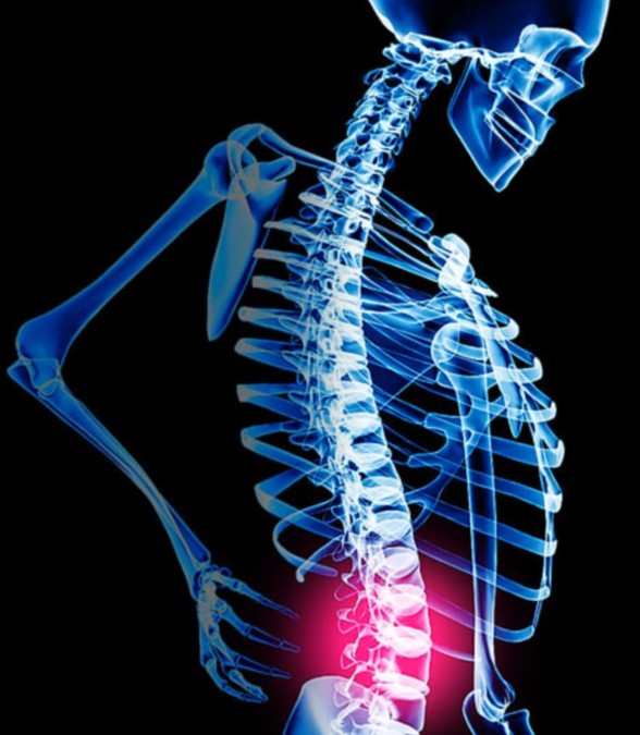 Myofascial Technique for Back Pain